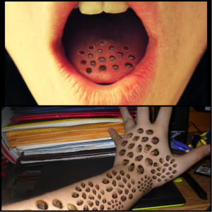 Trypophobia_1